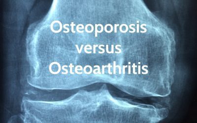 Osteoporosis versus Osteoarthritis