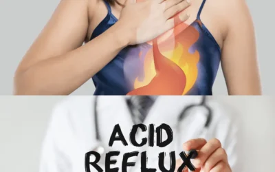 GERD Acid Reflux: Symptoms, Causes, and Treatment