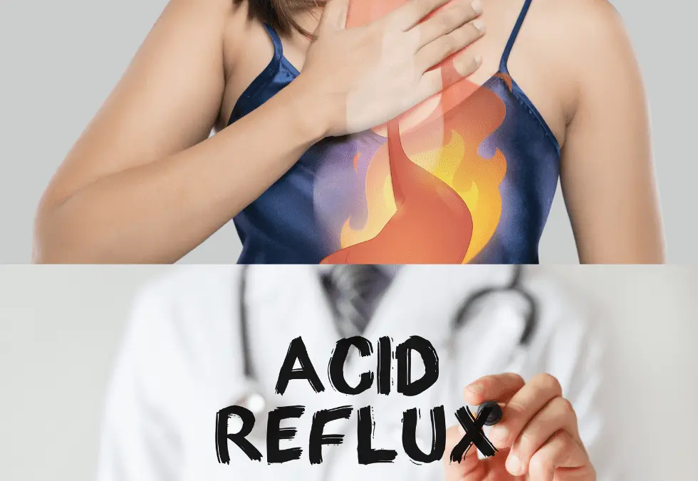 GERD Acid Reflux: Symptoms, Causes, and Treatment