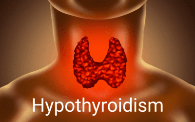 Hypothyroidism